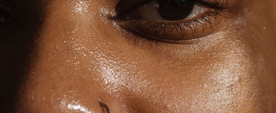 Pele Oleosa na Perimenopausa: Por Que Isso Acontece Antes da Pele Ficar Seca