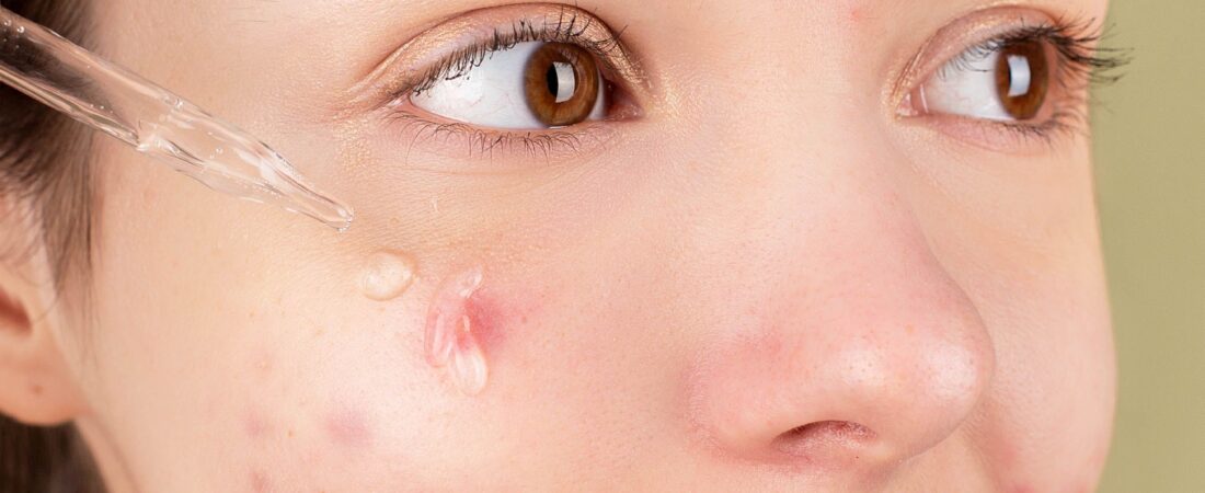 Peptídeos na Pele Madura: Para Que Servem e Como Usar