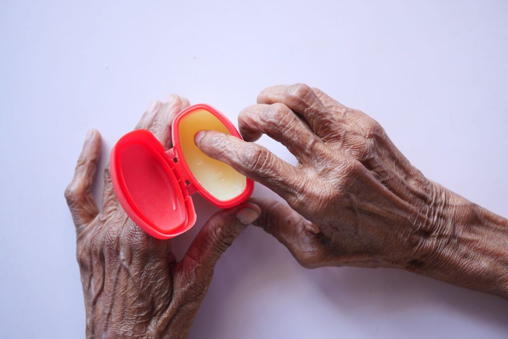 Pele fina na menopausa: mãos maduras aplicando creme hidratante