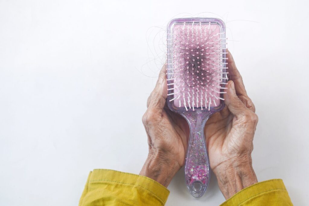 mãos segurando escova com fios de cabelo, sinal de queda de cabelo na mulher adulta