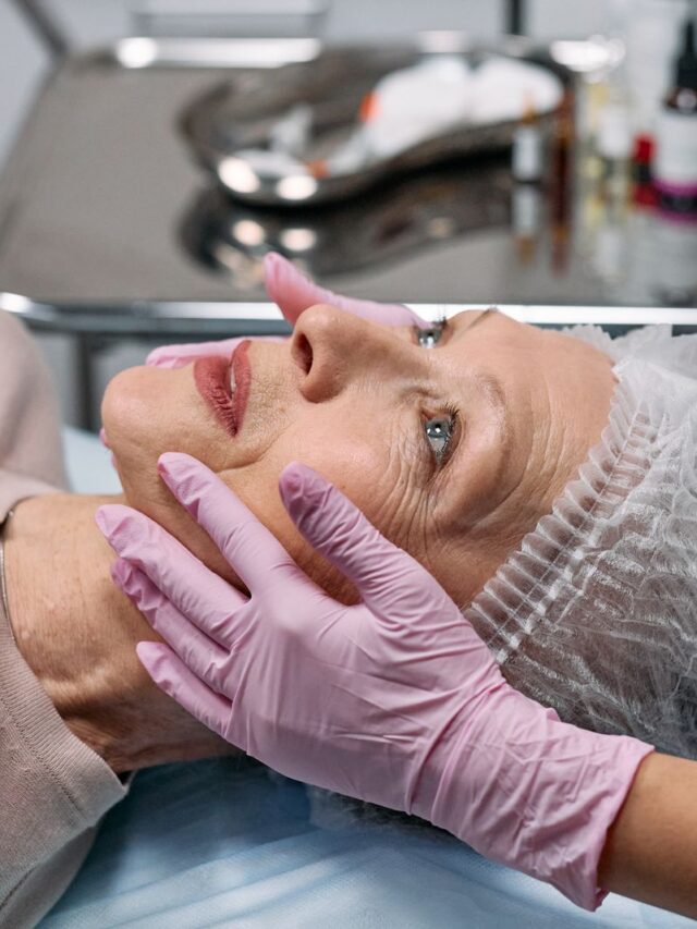 Queratose seborreica: pode arrancar em casa? Não