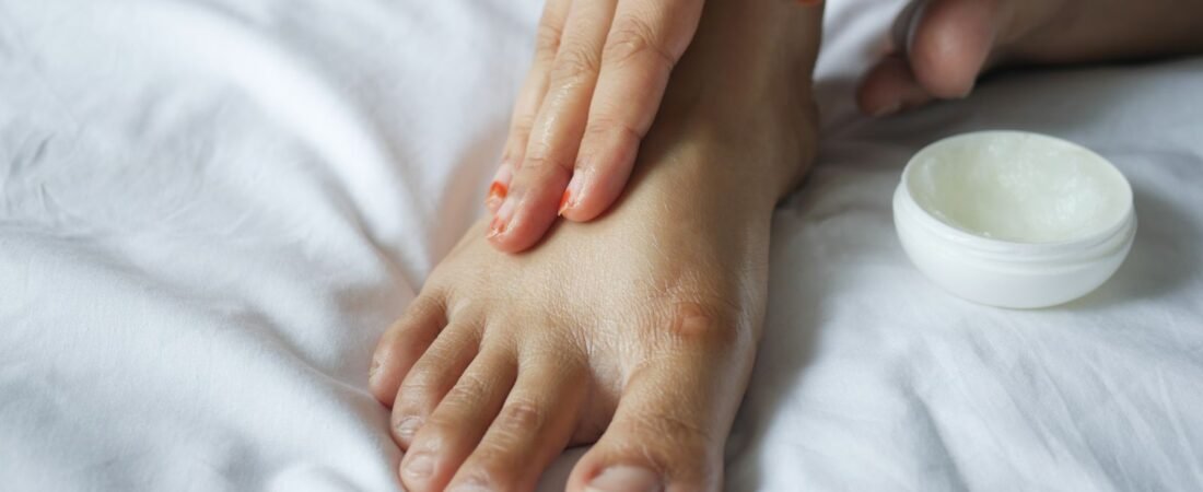 Calcanhar rachado: causas e o que dermatologistas recomendam