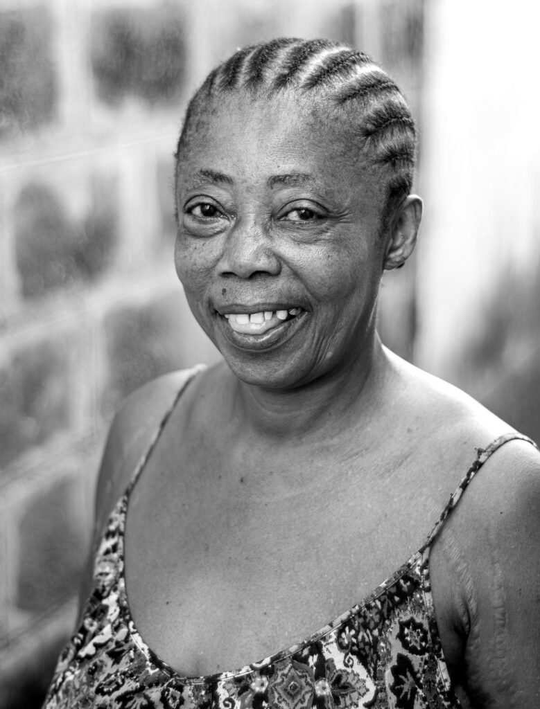 Dermatose papulosa nigra: retrato de mulher negra madura