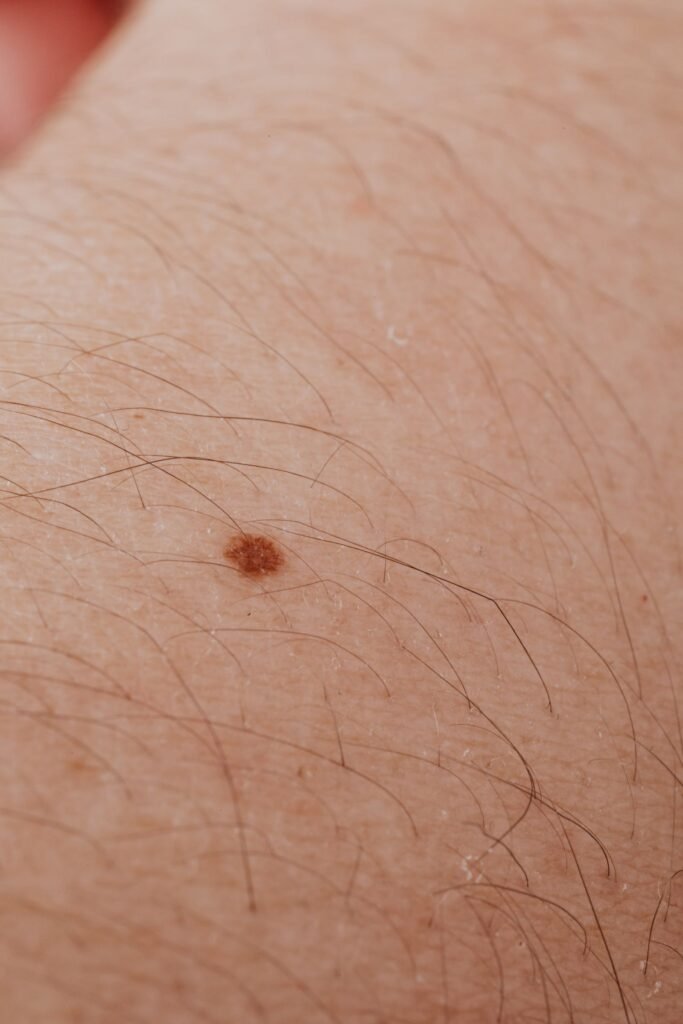 Pinta escura na pele vista de perto