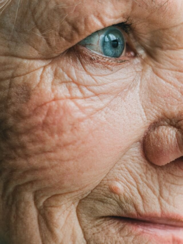 Pelos no rosto na menopausa? Raspar não engrossa