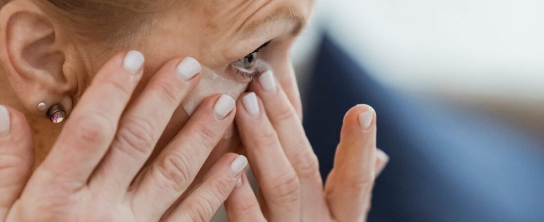 Siringoma: as bolinhas embaixo dos olhos que não são milium
