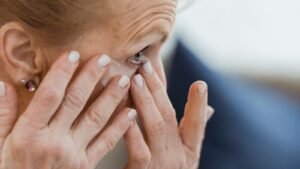 Siringoma: as bolinhas embaixo dos olhos que não são milium